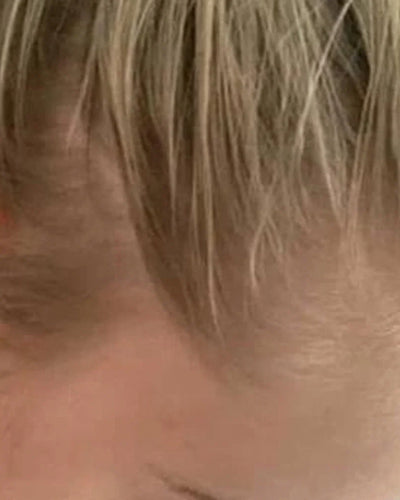Efter — Kund