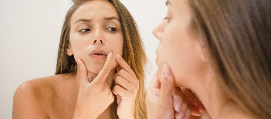Guide: Få bort svarta pormaskar på näsan