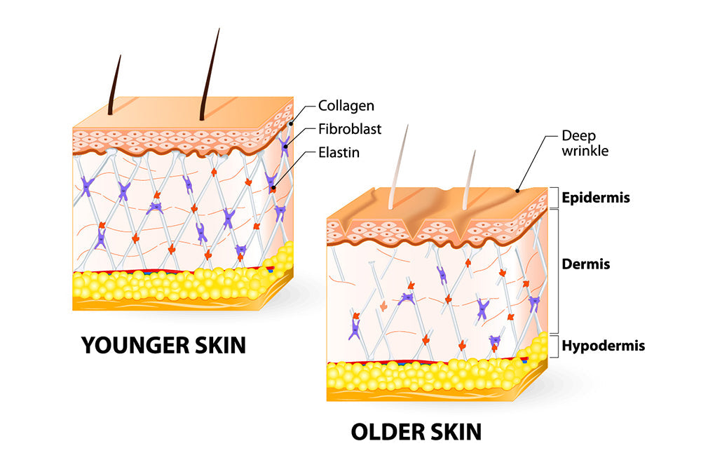 Så_funkar_microneedling