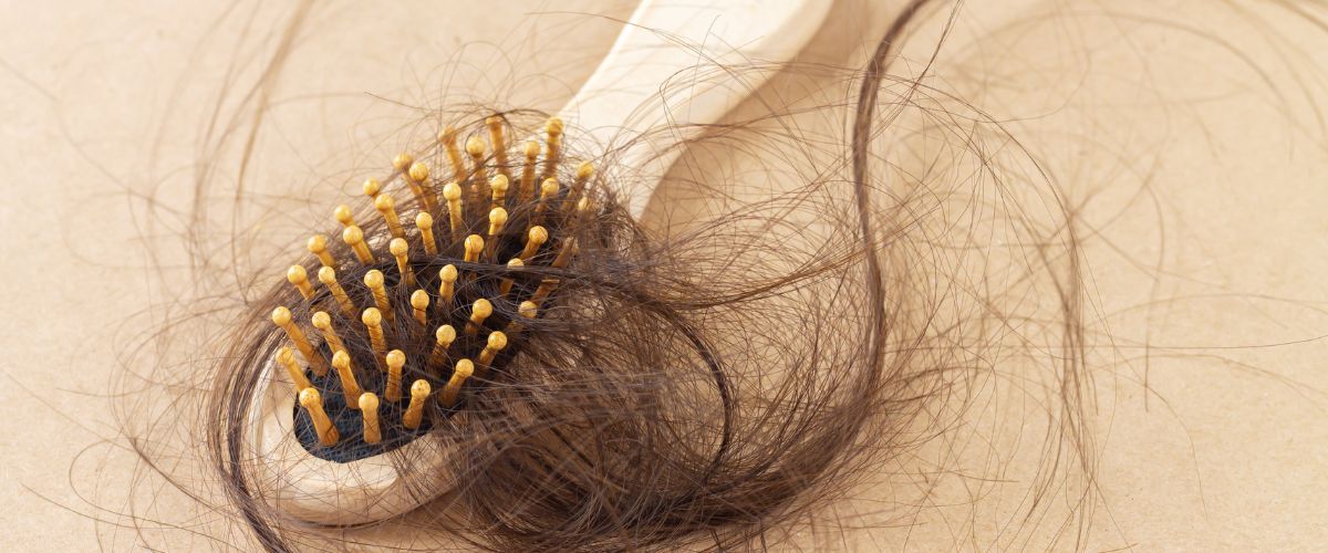 Image of Håravfall - varför tappar jag hår?