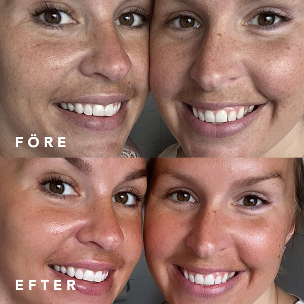 Image of Skinroller + Radiant Vitamin C-serum 30ml