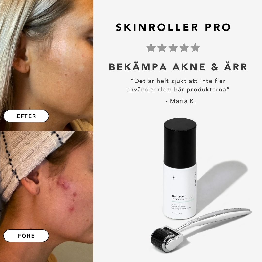 Behandla bristningar & celluliter med Skinroller