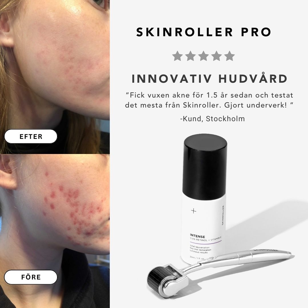 Skinroller Pro - Dermaroller