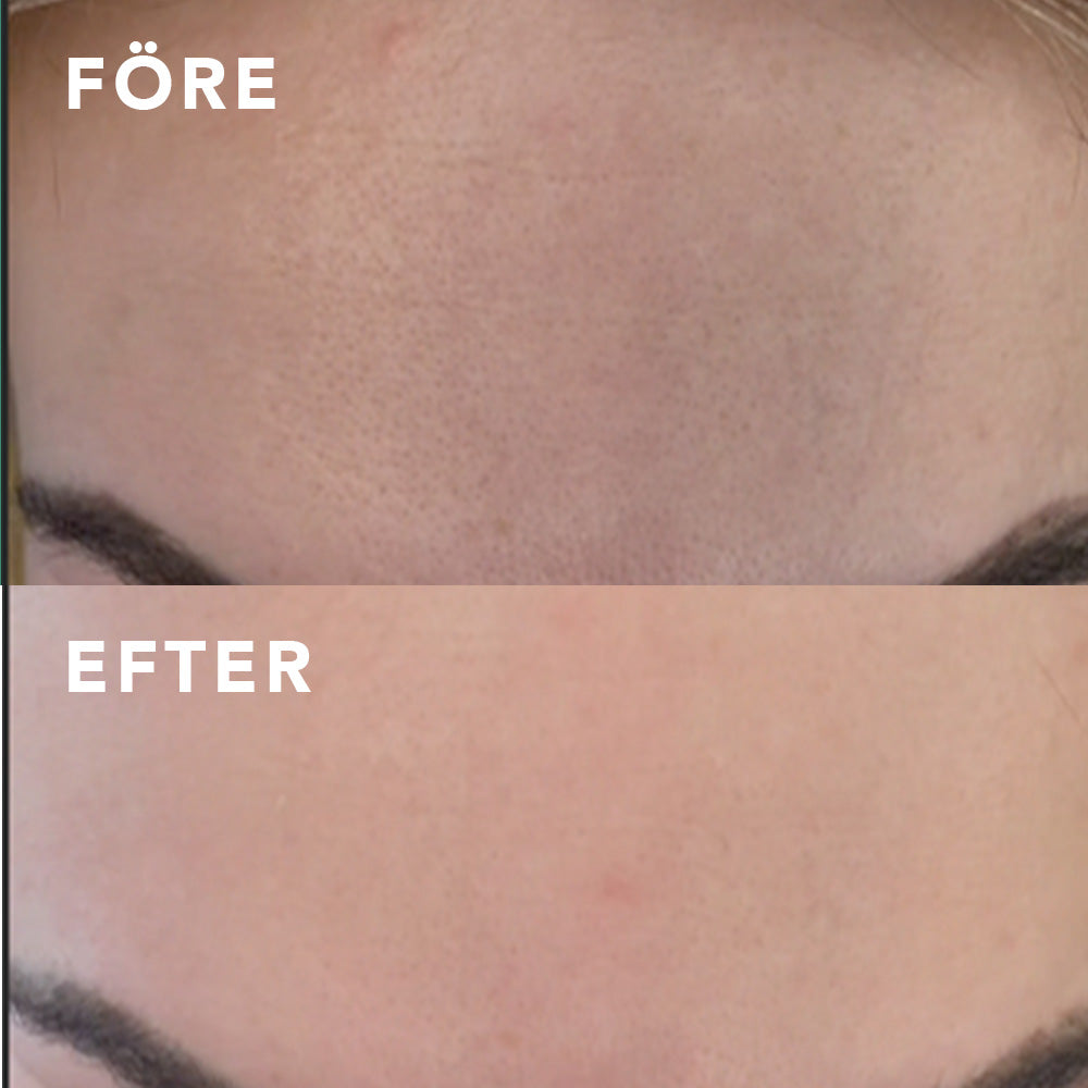 Image of Bye Bye Pores - 2-stegs kit