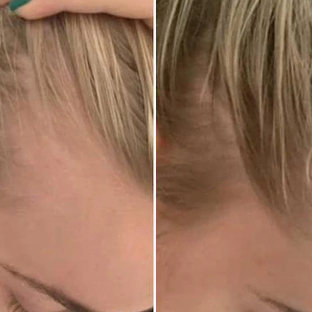 Image of Hair Growth Serum - Paksumpi ja vahvempi hiustenkasvu