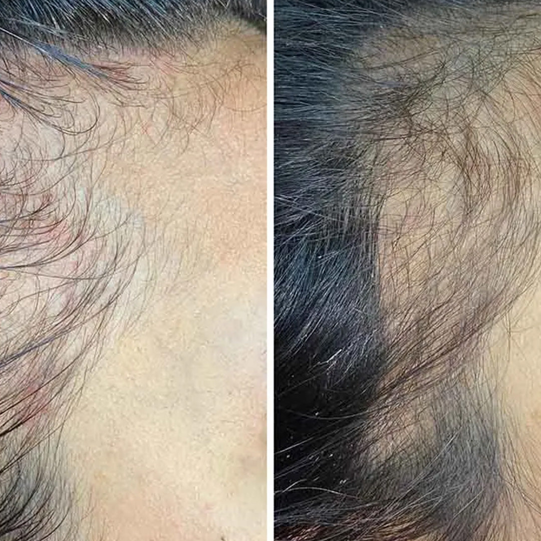 Image of Hair Growth Serum - Paksumpi ja vahvempi hiustenkasvu