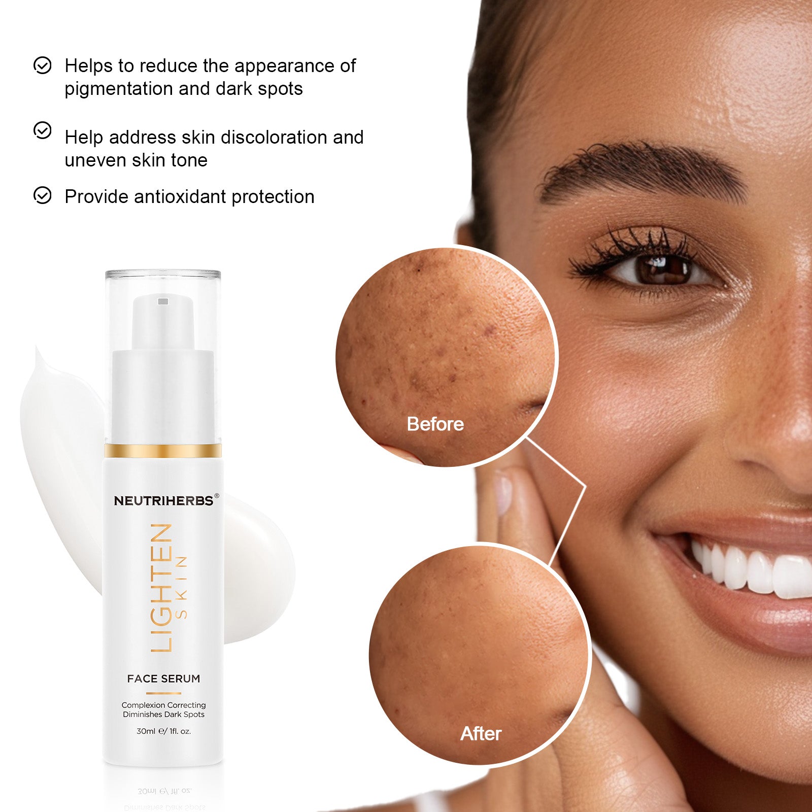 Image of Lightening Skin Serum - Mot pigmentfläckar - Neutriherbs