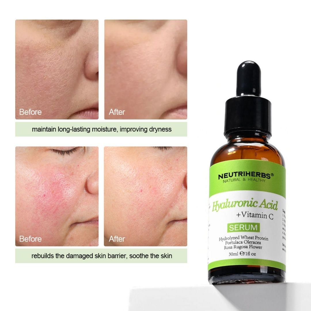 Image of Hyaluronic Acid 5% + Vitamin C Serum - 30 ml - Neutriherbs