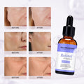 Retinol (Vitamin A) +Vitamin E Serum - 30 ml (0.25%) - Neutriherbs