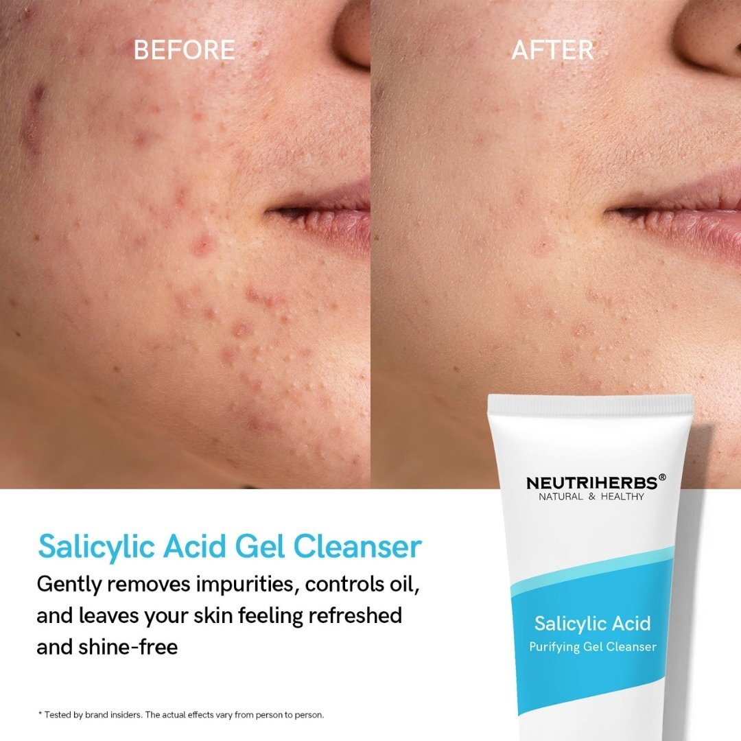 Salicylic Acid Duo Kit - Cleanser & Serum Neutriherbs