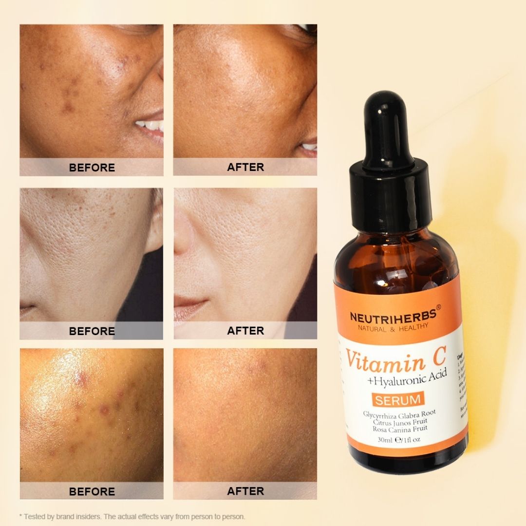 Image of 10% Vitamin C Serum + Hyaluronsyra - 30 ml - Neutriherbs