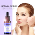 Retinol (Vitamin A) +Vitamin E Serum - 30 ml (0.25%) - Neutriherbs