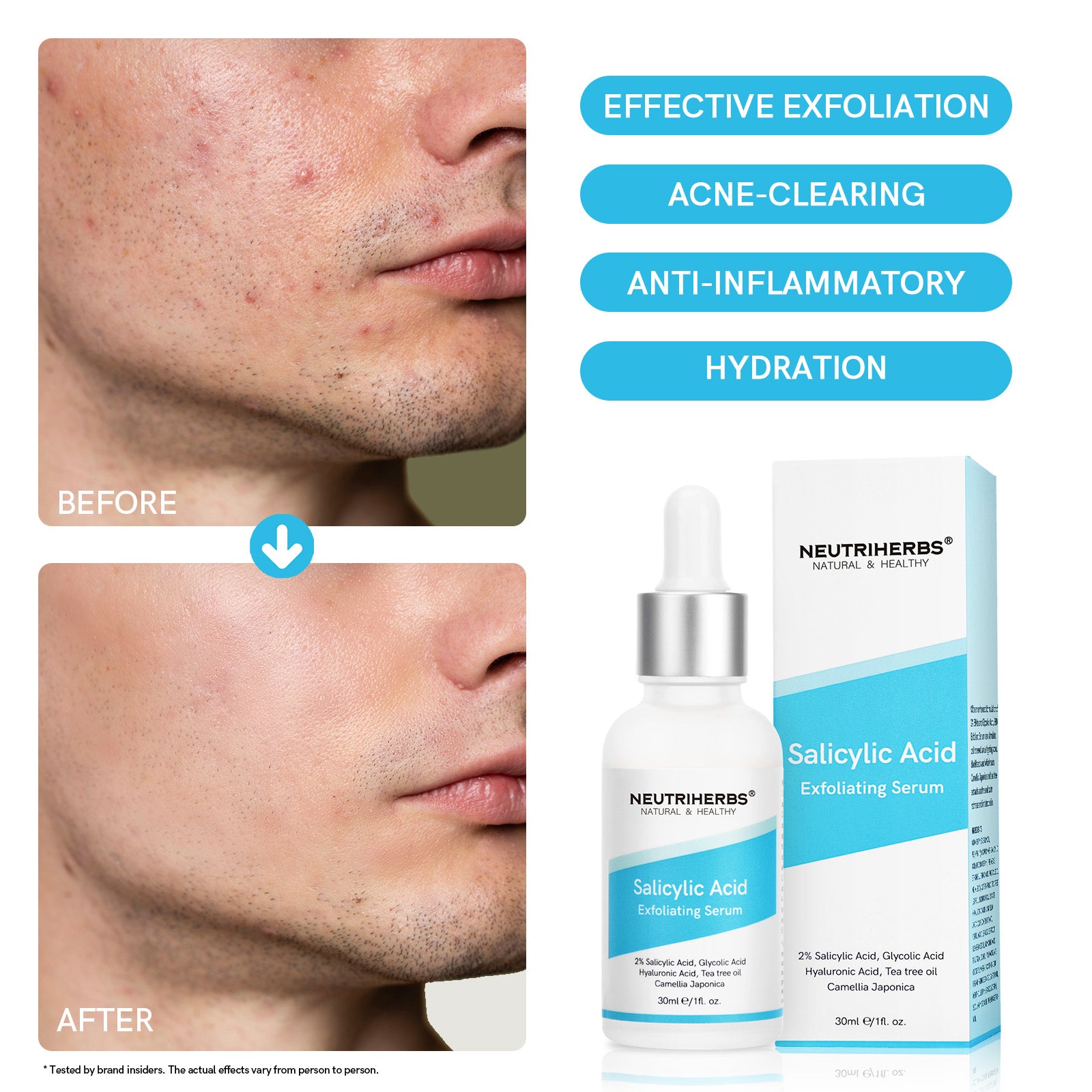 Image of Salicylic Acid Duo Kit - Cleanser & Serum Neutriherbs