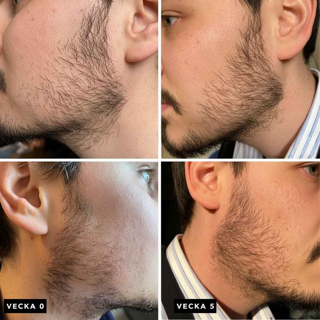 Beard & Cleanse Growth Kit