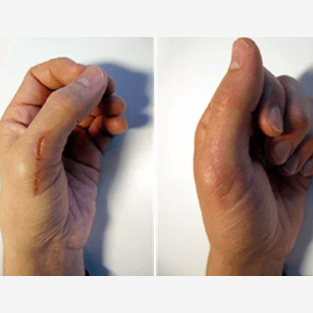 Image of Cicamed Scar 15 g - Ärrbehandling