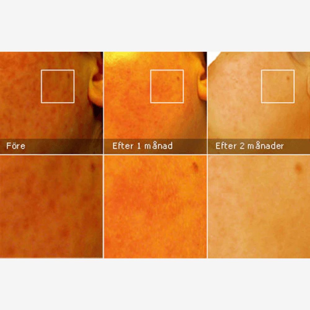 Image of Cicamed Scar 15 g - Ärrbehandling