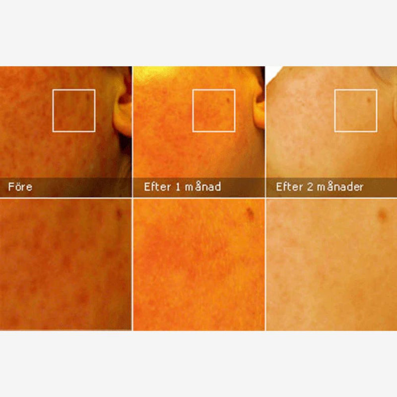 Cicamed Scar 15 g - Ärrbehandling