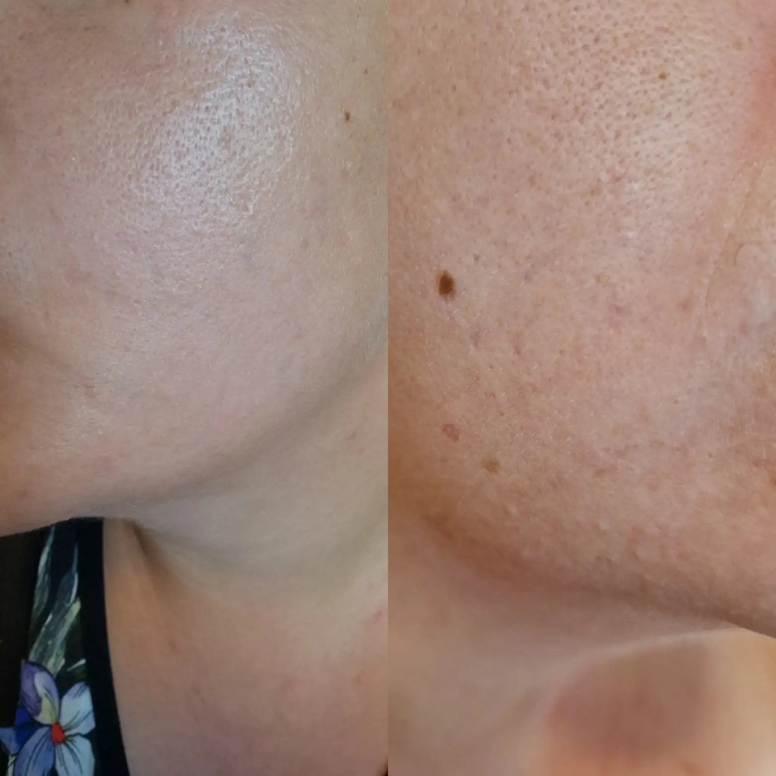 2% BHA Clarifying Toner - 100 ml