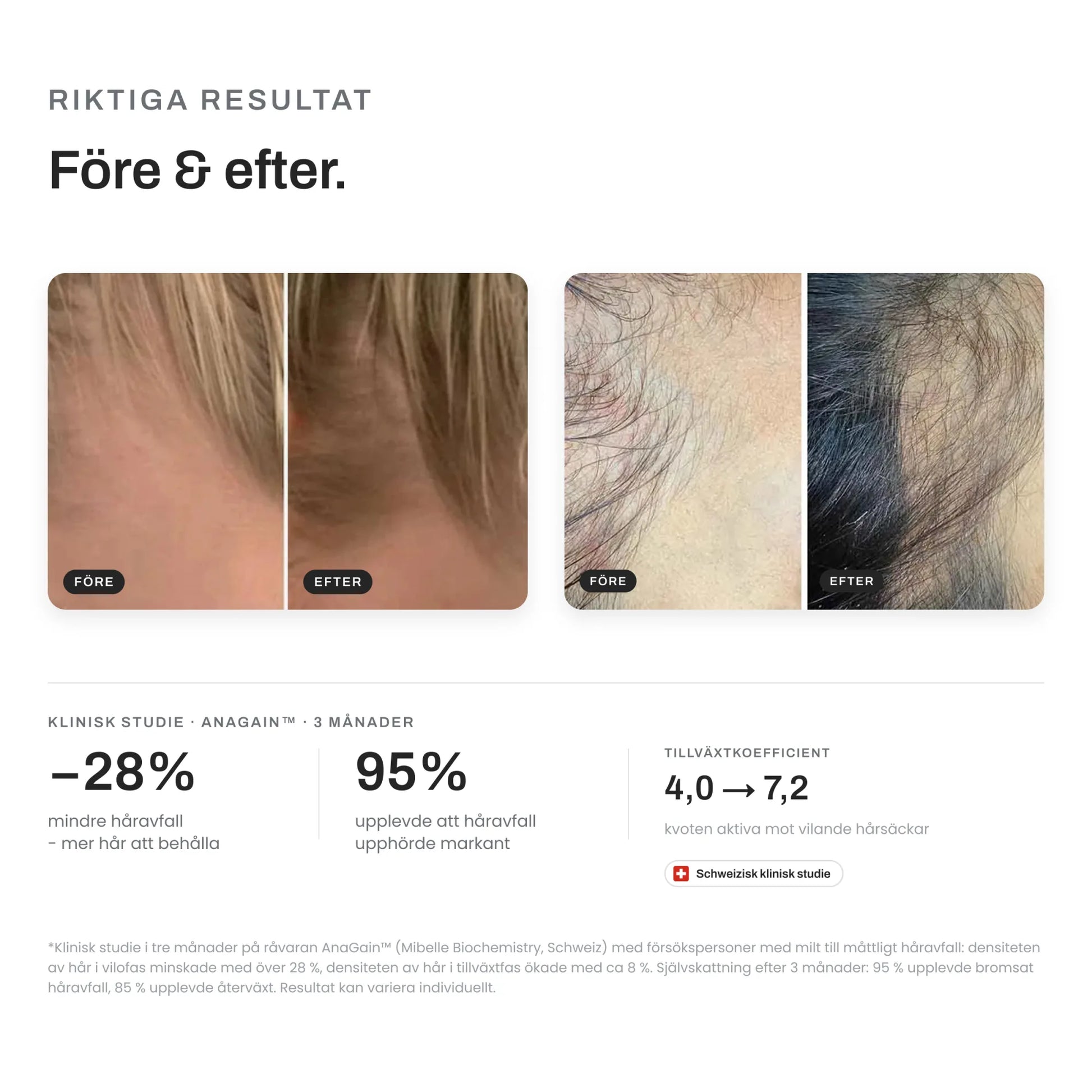 Före och efter 3 månader med Skinroller Hair Growth Kit – tätare hår och minskat håravfall