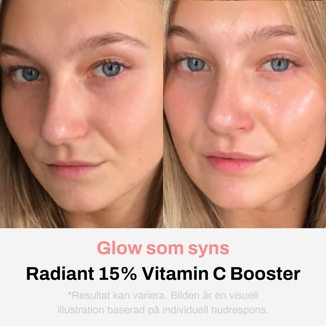 Image of Radiant Vitamin C Serum 15% Booster - Serum för lyster